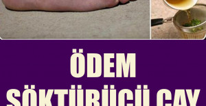 Ödem Söktürücü Çay Tarifi	