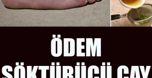 Ödem Söktürücü Çay Tarifi