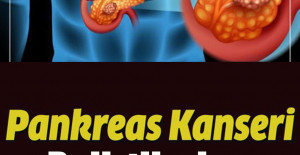 Pankreas Kanseri Belirtileri ve Evreleri Neler