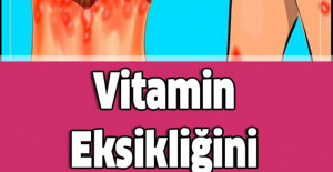 Vitamin Eksikliğini Belirten İşaretler Ve Nasıl Onarılır