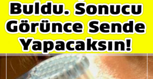 Bir Kadın Siyah Noktalara Tamamen Yeni Bir Çözüm Buldu