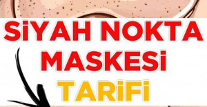 Siyah Nokta Maskesi Tarifi