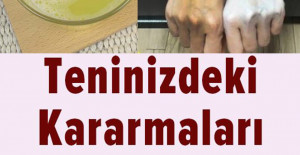 Vücuttaki Kararmalardan Nasıl Kurtulursunuz