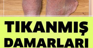 Damarlarınızı Tertemiz Yapacak Sır