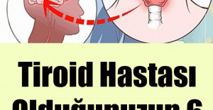 Tiroid Hastası Olduğunuzun 6 Gizli İşareti	