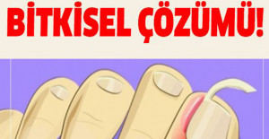 TIRNAK BATMASI BİTKİSEL ÇÖZÜMLER