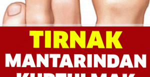 Tırnak Mantarından Kurtulmak Bu Kadar Basitmiş