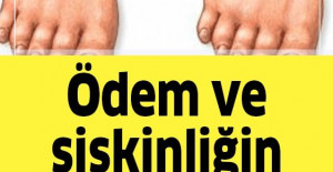 İnsanda Ödem ve Şişkinliğin Zerresini Bırakmayan Yiyecek