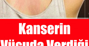 Kanserin Vücuda Verdiği 10 Belirti