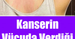 Kanserin Vücuda Verdiği 10 Belirti