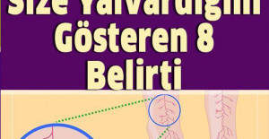 Vücudunuzda Magnezyum Eksikliğini Gösteren 8 Belirtisi