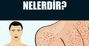 Yağlı Karaciğer Hastalığı Belirtileri