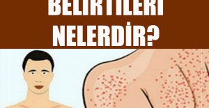 Yağlı Karaciğer Hastalığı Belirtileri	