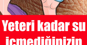 Yeteri kadar su içmediğinizin 8 belirtisi