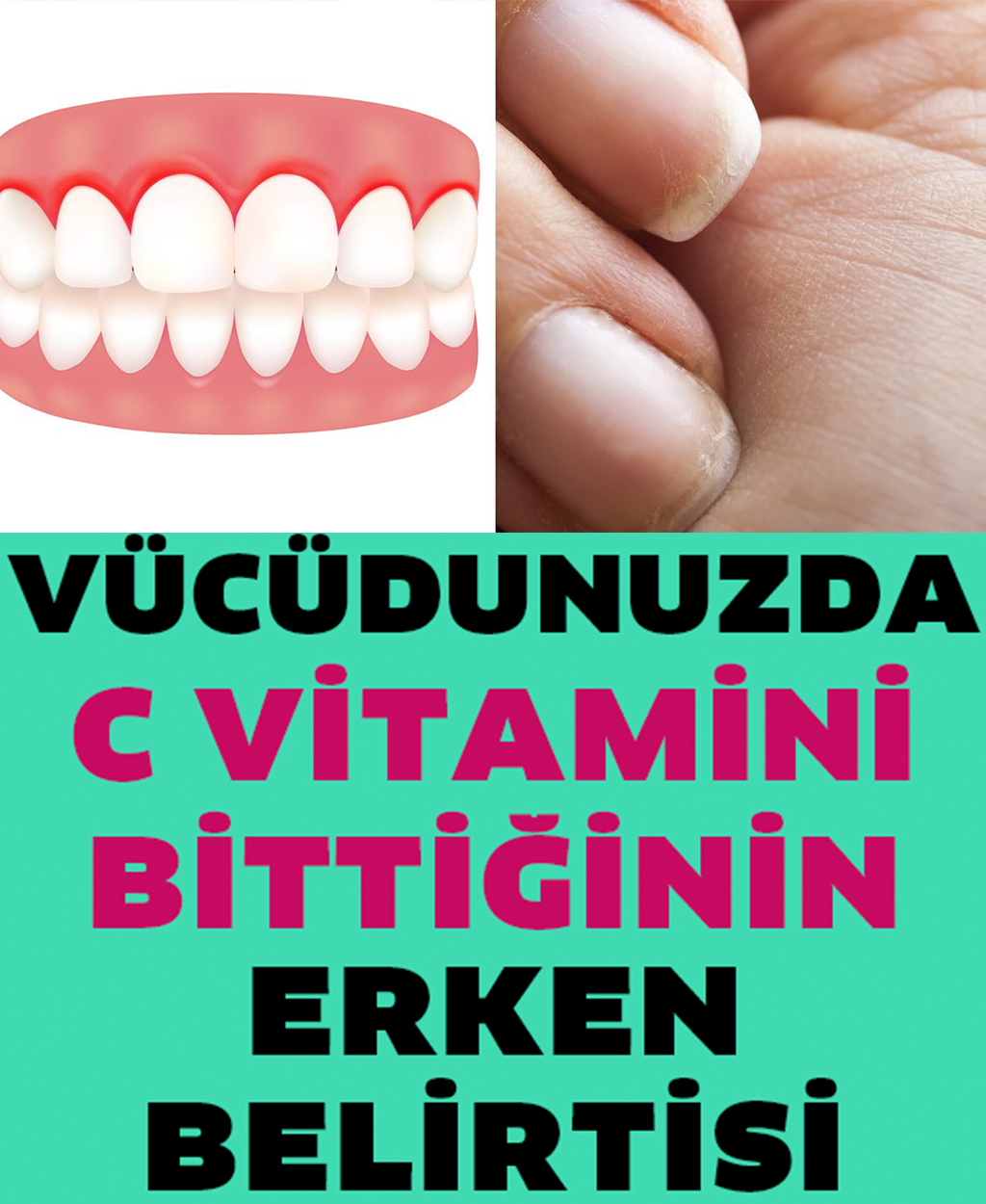 Vücudunuzun C Vitamini Bitmiş Olduğunun 10 Erken Belirtisi - 1