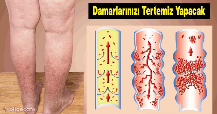 Damarlarınızı Tertemiz Yapacak Sır - 3