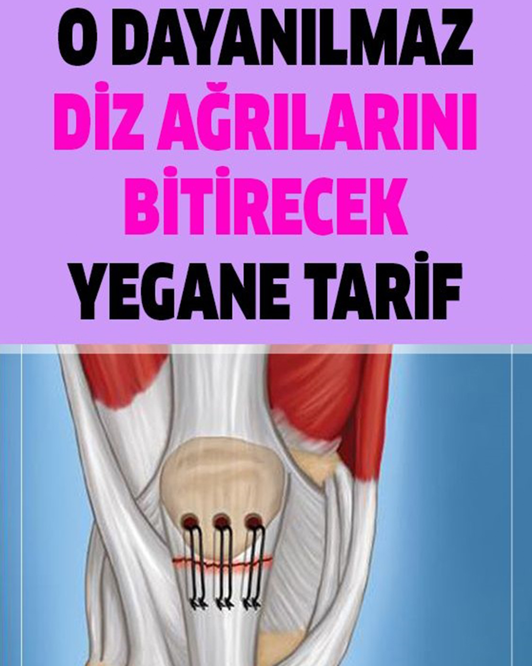 Dayanılmaz Diz Sızılarına Şifa - 1
