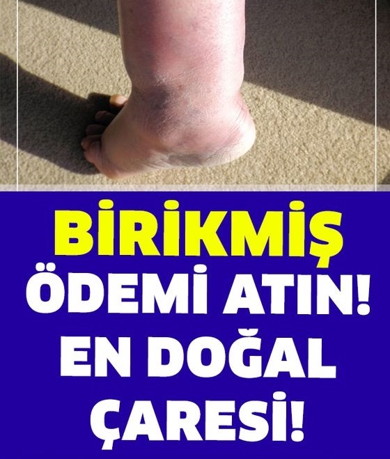 Birikmiş Ödemi Atmanın En Doğal Çaresi - 1