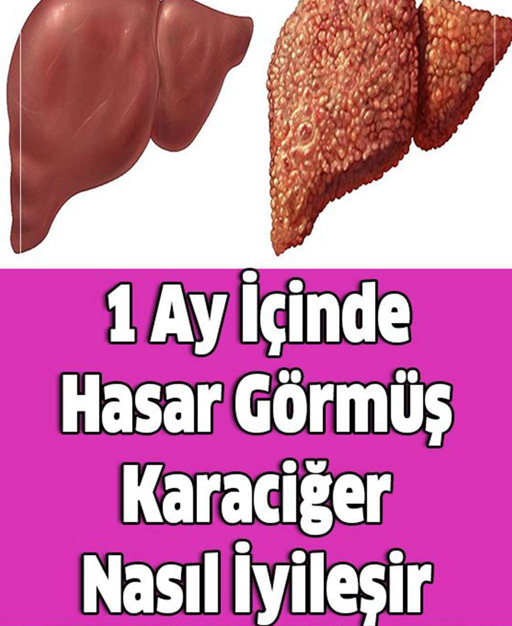 1 Ay İçinde Hasar Görmüş Karaciğer Nasıl İyileşir - 1