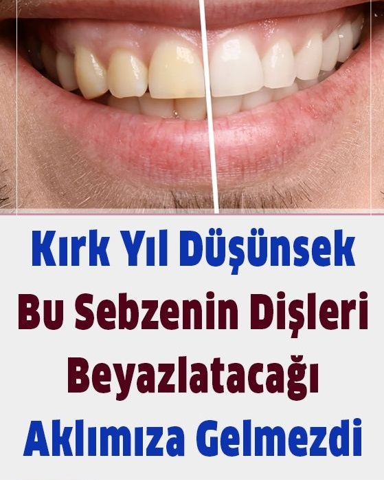 Dişleri beyazlatan sebzeler - 1