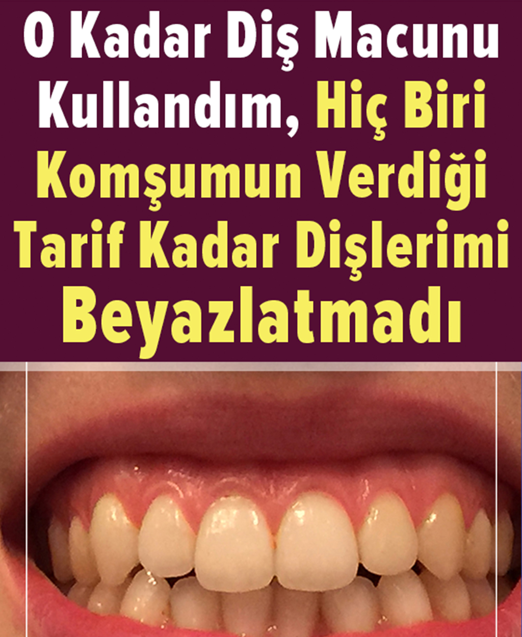 Hiç Bir Şey Komşumun Verdiği Tarif Kadar Dişlerimi Beyazlatmadı - 1