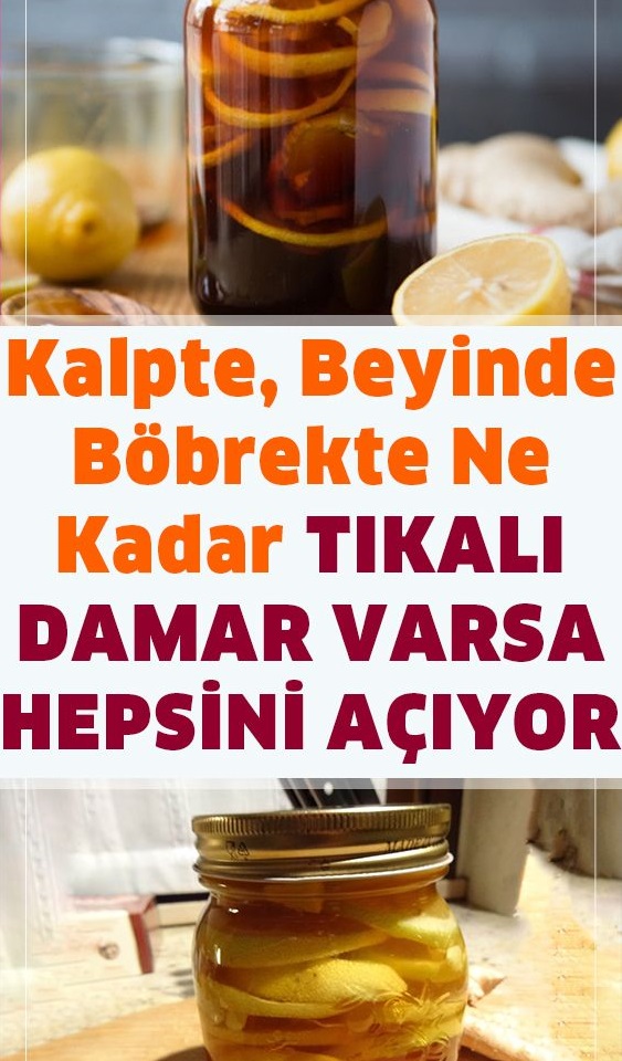 Tıkalı Damarları Açan Doğal Yöntem - 1