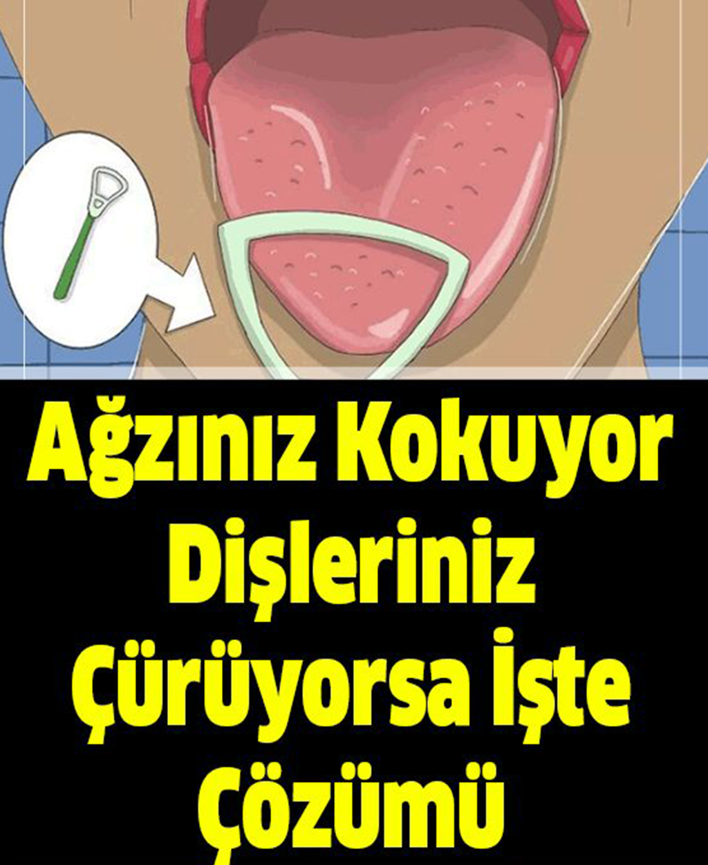 Ağzınız Kokuyor Dişleriniz Çürüyorsa İşte Çözümü - 1