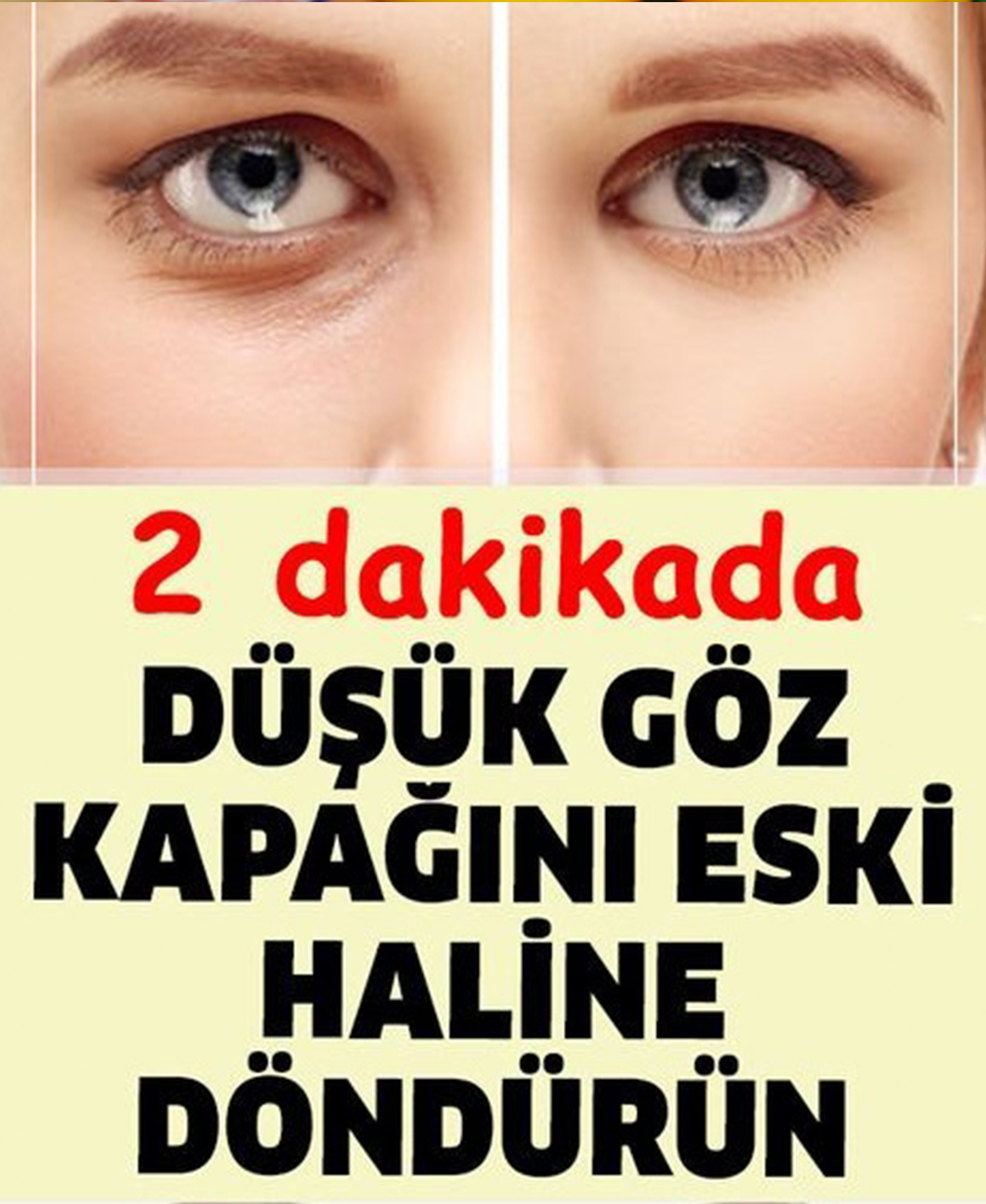 Düşük Göz Kapağını Eski Haline Getirmenin Püf Noktası - 1