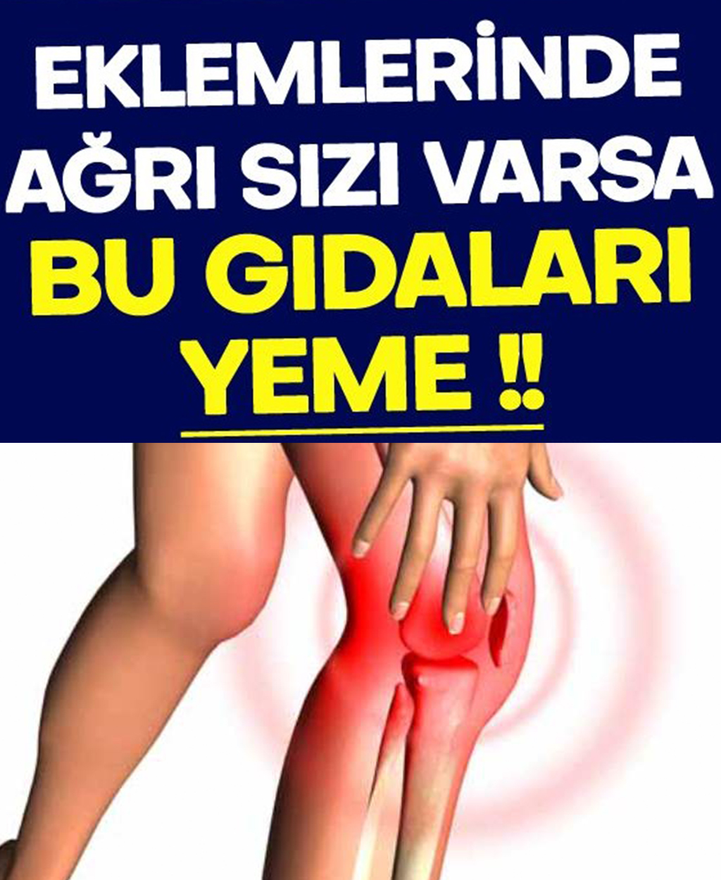 Eklemlerinde ağrı olan var bu gıdaları tüketmesin - 1