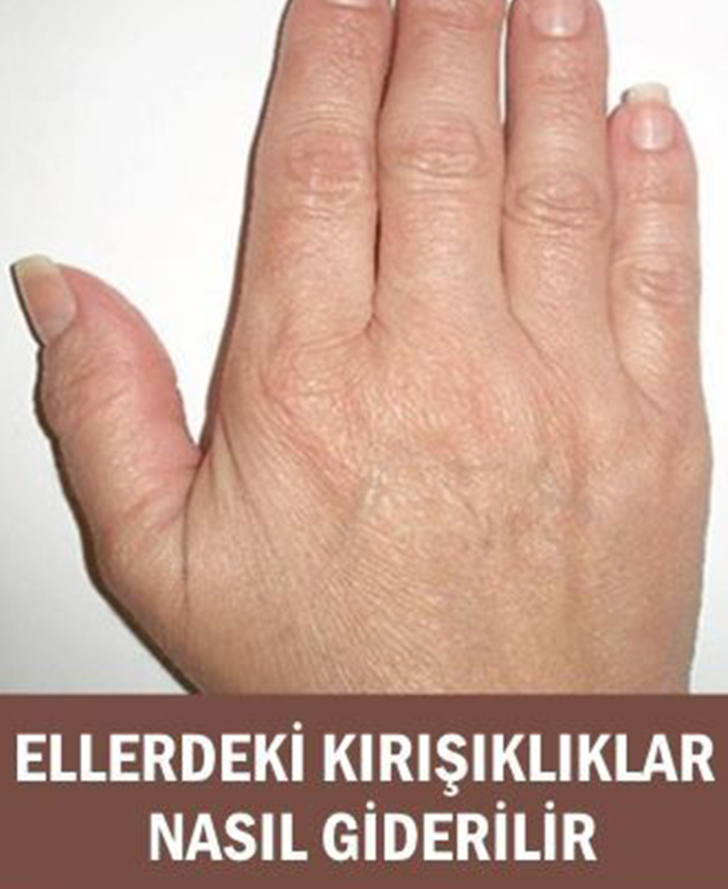 El Kırışıklıklarını Bitiren Doğal Yöntem - 1