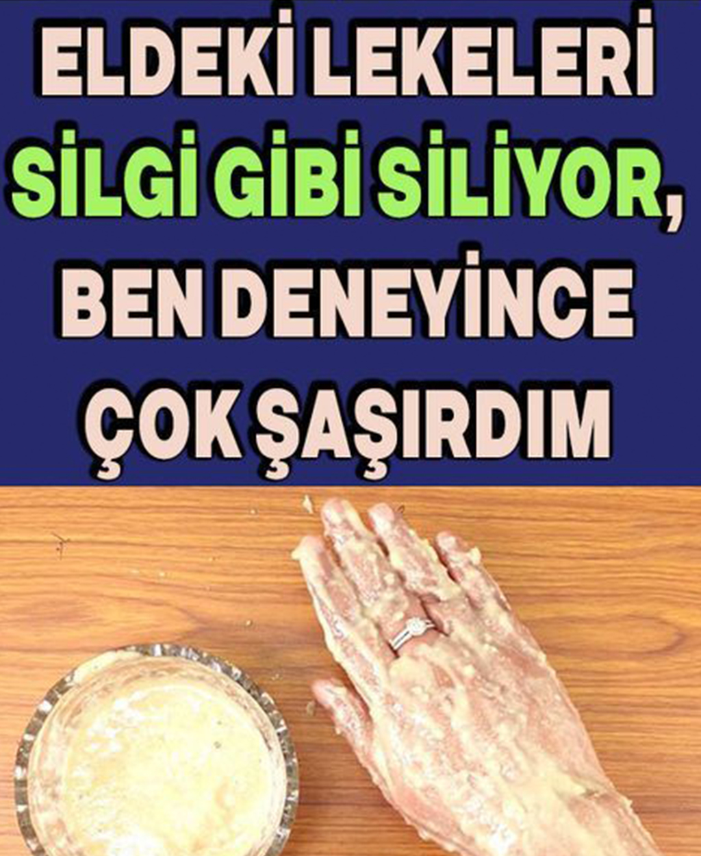 Eldeki Lekeleri Silgi Gibi Siliyor, Ben Deneyince Çok Şaşırdım - 1