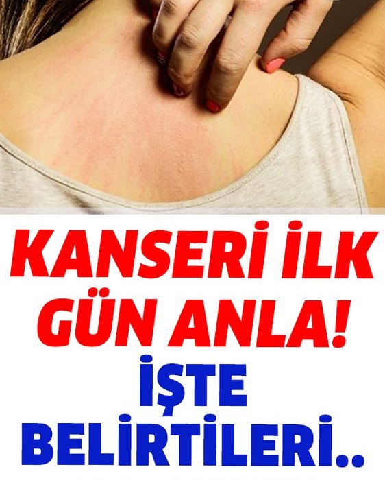Kanser Olup Olmadığınızın Belirtileri Nelerdir? - 1