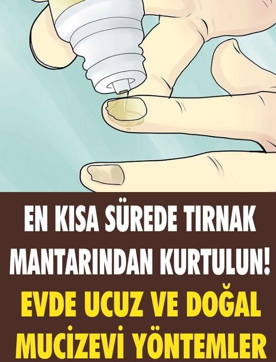 Tırnak Mantarına Doğal Çözümler - 1