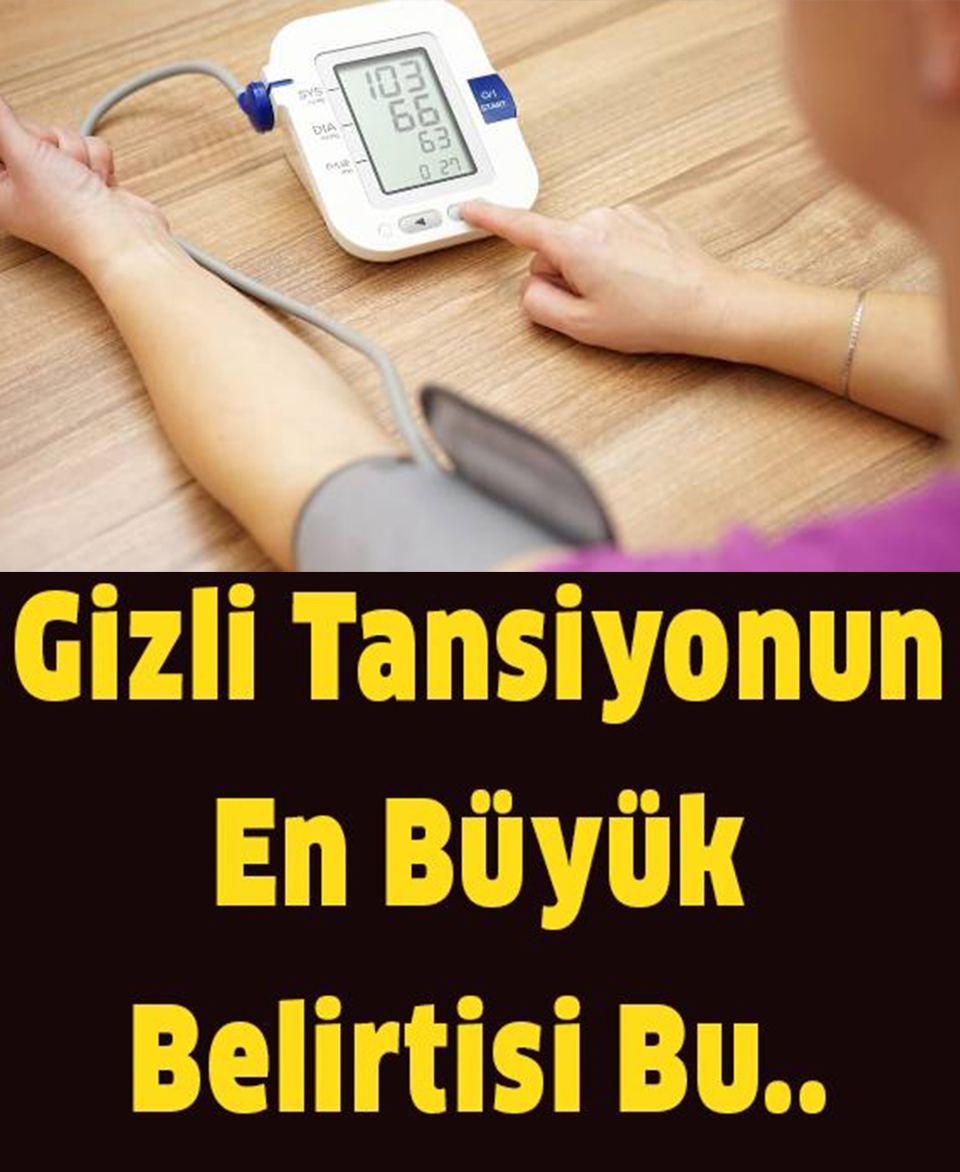 Saklı Tansiyonun Baş Bulgusu - 1