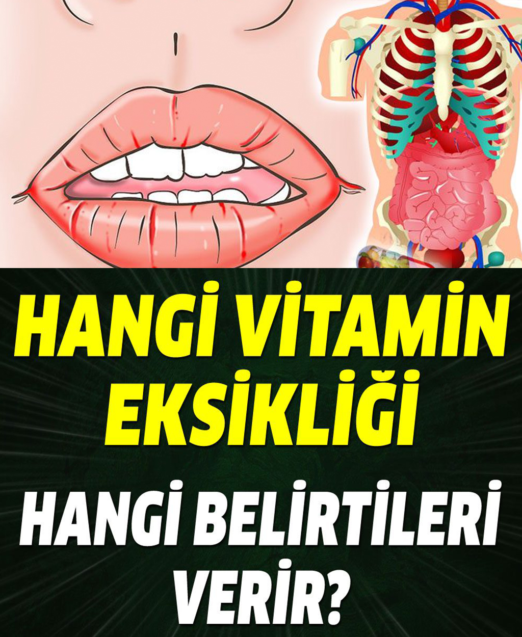 Hangi vitamin eksikliği hangi belirtileri verir? - 1