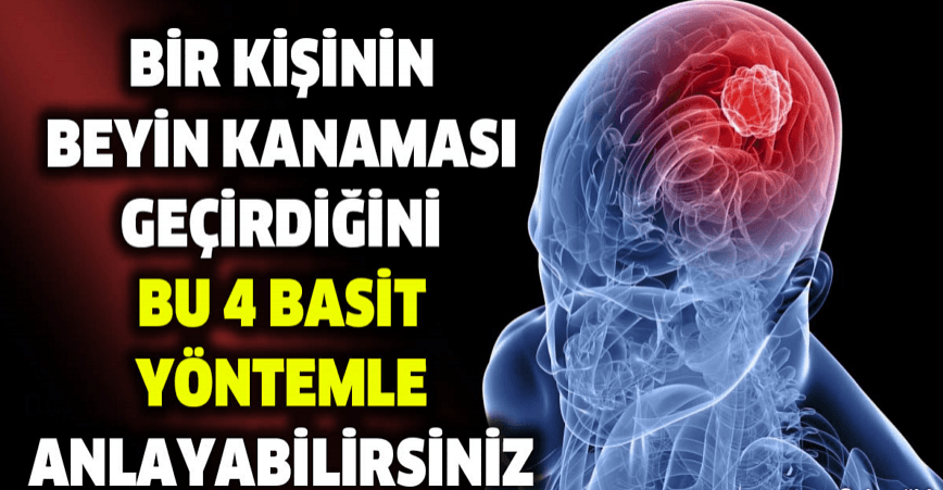 BİR KİŞİNİN BEYİN KANAMASI GEÇİRDİĞİNİ BU DÖRT BASİT YÖNTEMLE ANLAYABİLİRSİNİZ - 2