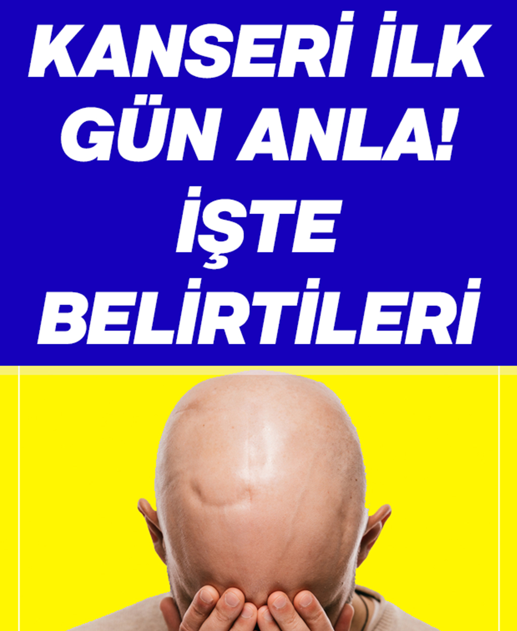 Kanseri İlk Gün Anla İşte Belirtileri - 1