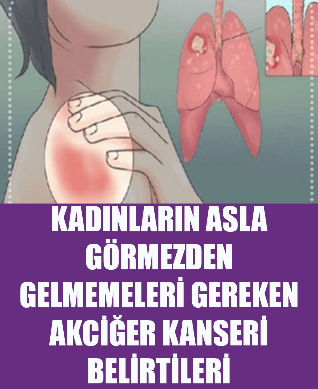 Kadınlarda belirtileri nelerdir - 1