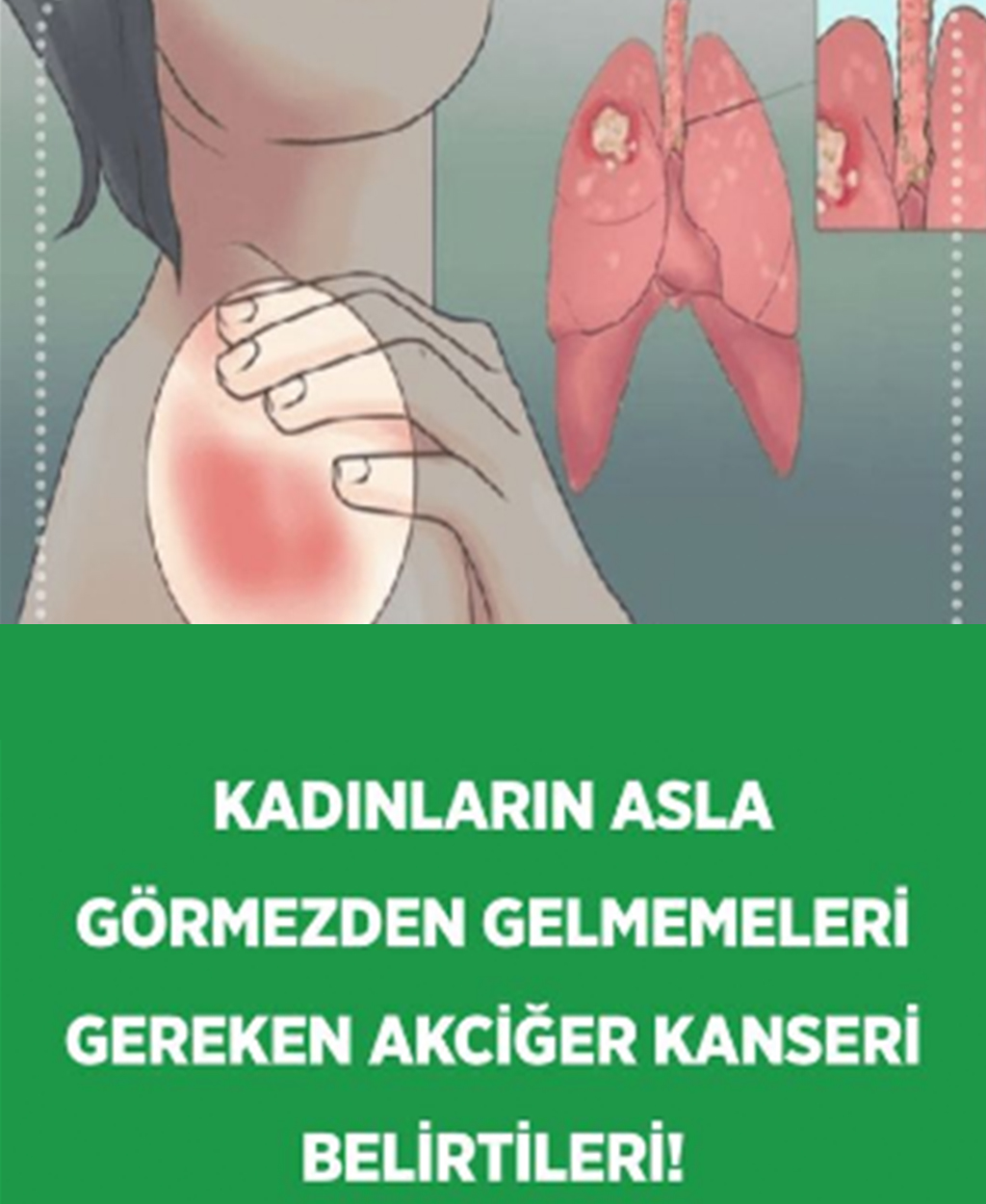 Kadınlarda belirtileri nelerdir - 1
