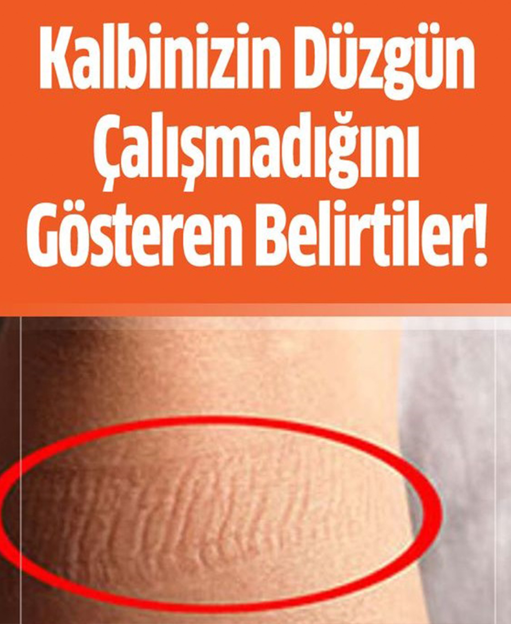 Kalbinizin düzgün çalışmadığını gösteren belirtiler - 1