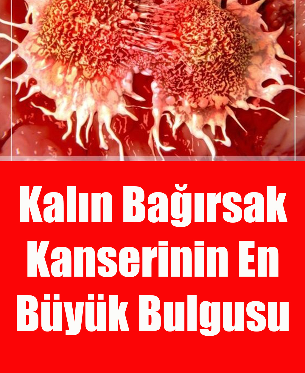 Kalın Bağırsak Kanserinin En Büyük Belirtisi Bu - 1