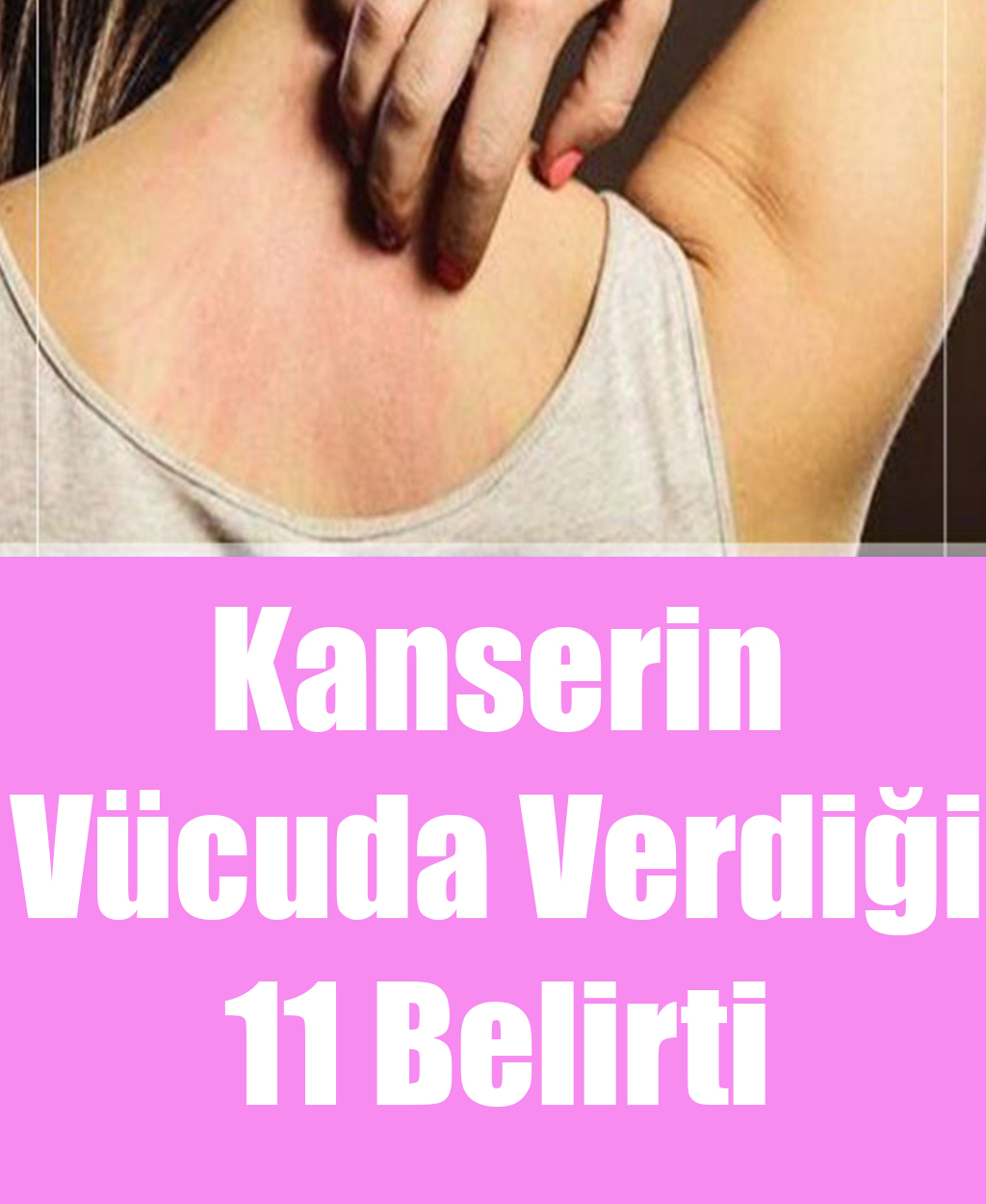 Kanserin Vücuda Verdiği 11 Belirti	 - 1