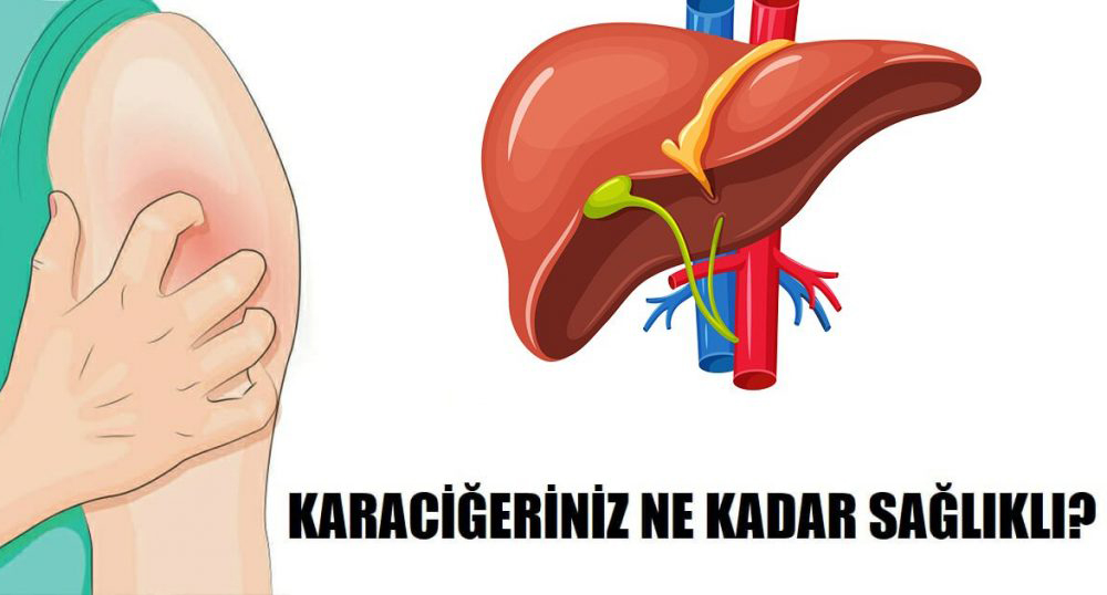 Düzgün Çalışmayan Bozulmuş Karaciğerin 5 Belirtisi - 2