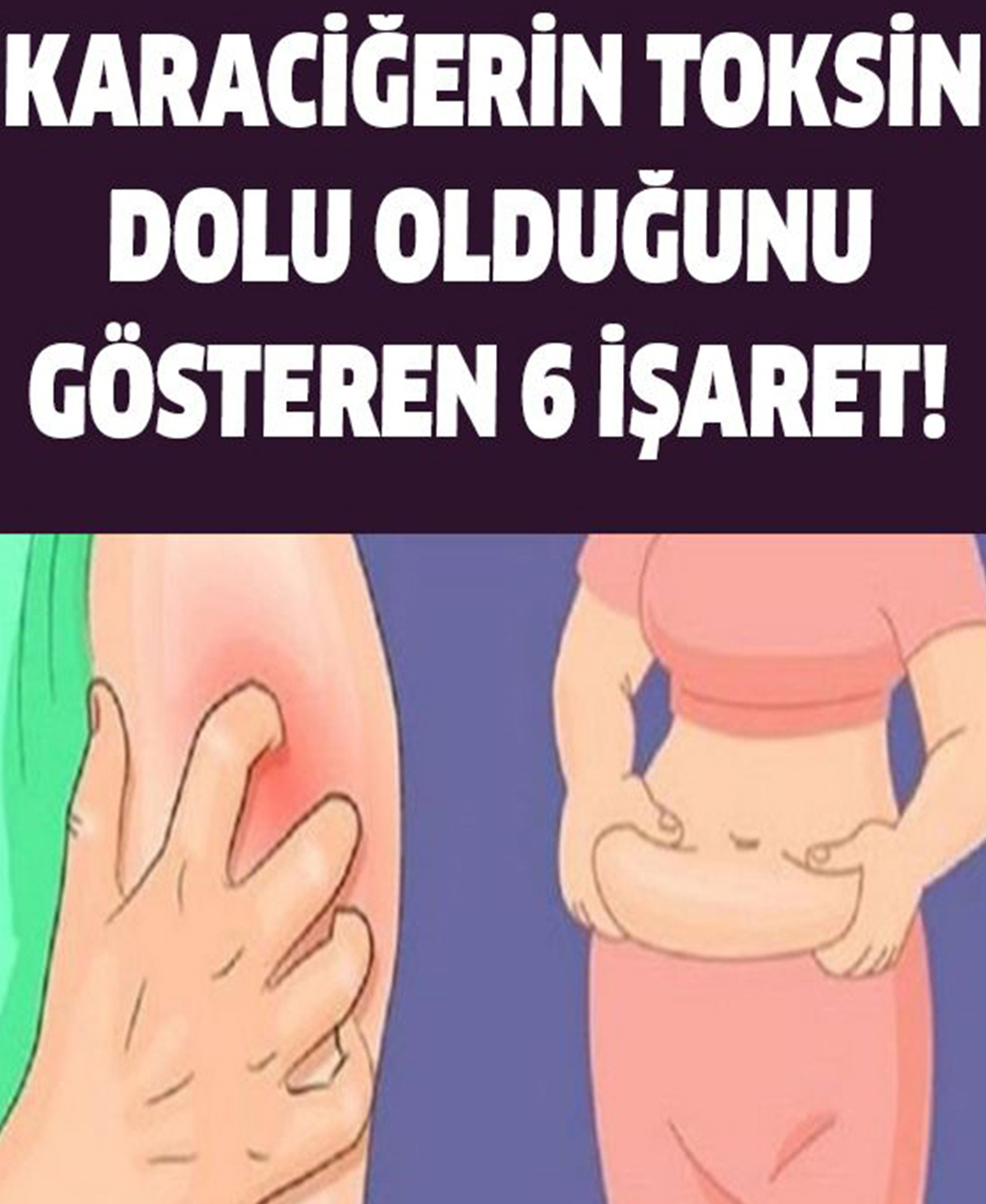 Karaciğerin Toksinlerle Dolu Olduğunu Gösteren 6 İşareti - 1