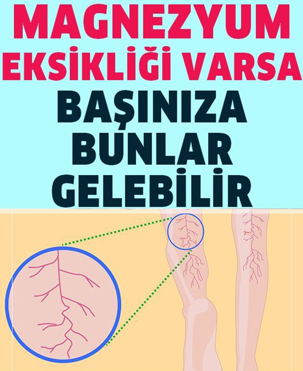 Vücudunuzda Magnezyum Eksikliğinin 13 Belirtisi - 1
