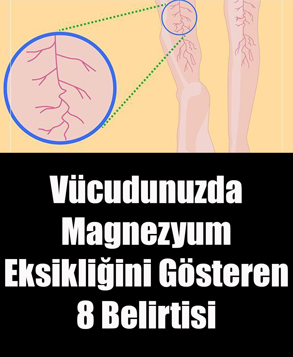 Vücudunuzda Magnezyum Eksikliğini Gösteren 8 Belirtisi	 - 1