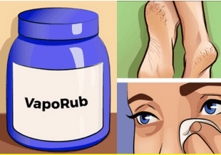 Her Kadın Vicks VapoRub İle Bu 12 Püf Noktaları Bilmeli - 2
