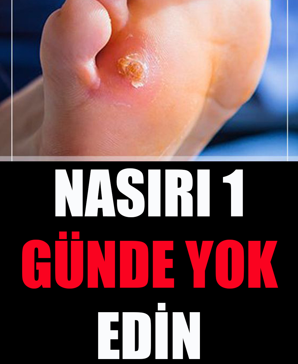 Nasırı 1 Günde Yok Edin - 1
