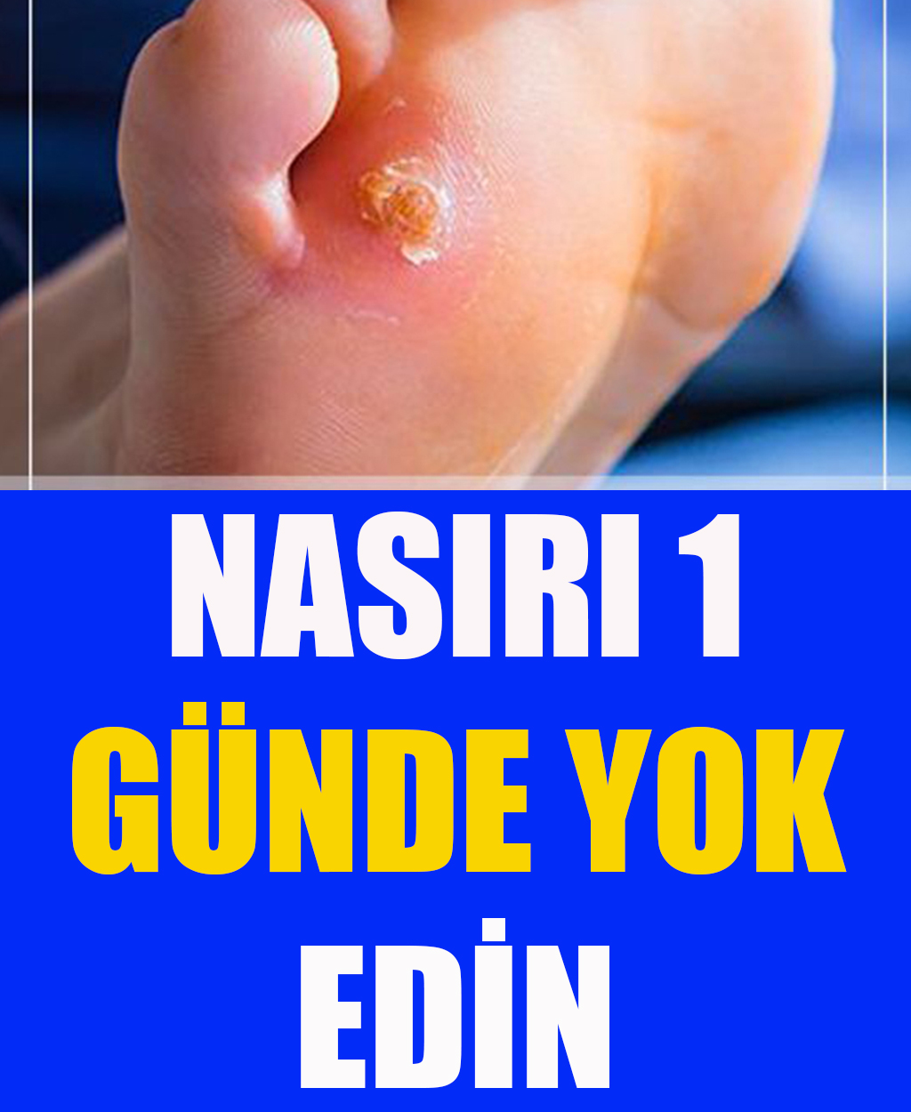 İşte Nasırdan 1 Günde Kurtaracak Doğal Tedavi Yöntemleri - 1