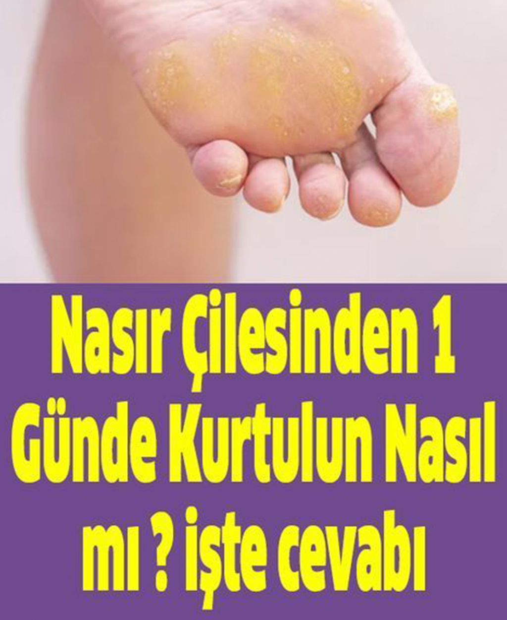 Nasır Çilesinden 1 Günde Kurtulun - 1